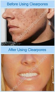 jennifer success stories
