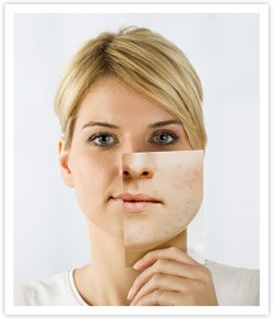 Buy Clear Pores